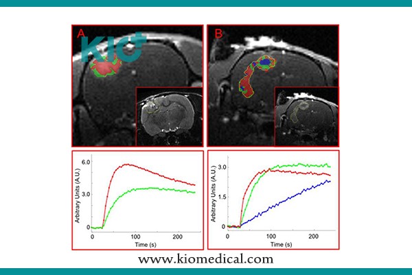 brain-mapping-kiomedical
